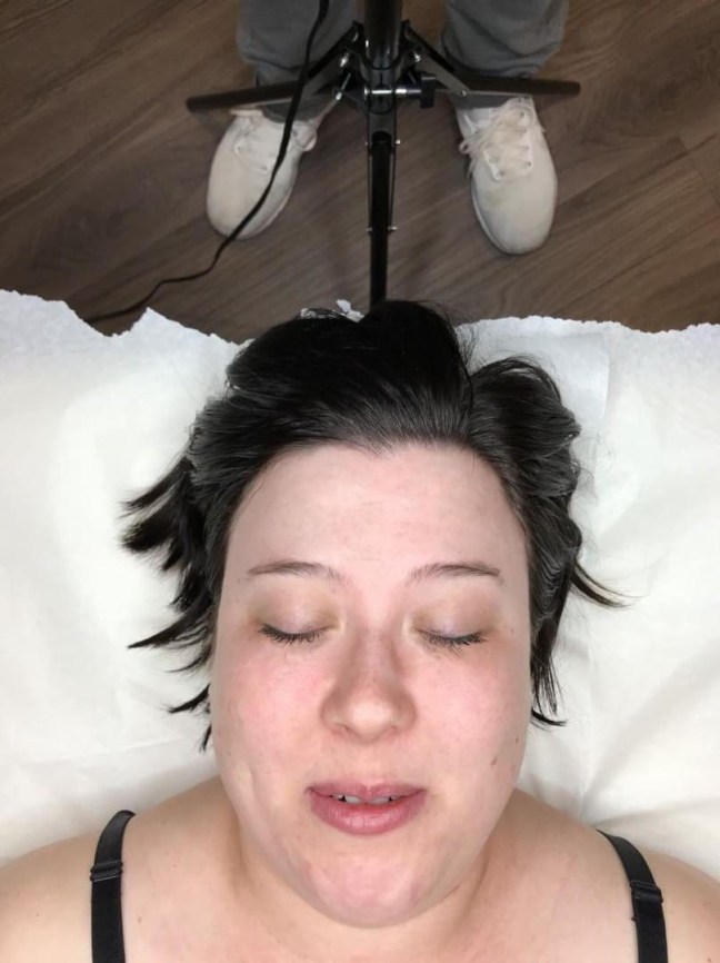 microblading before pic2